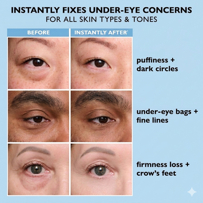 Celviron™ Instant Face Temporary Tightener – Instant visible results in 60 seconds